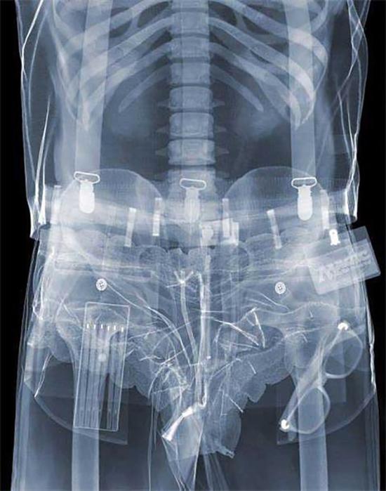 別想走私！直擊現(xiàn)在安檢機到底多厲害